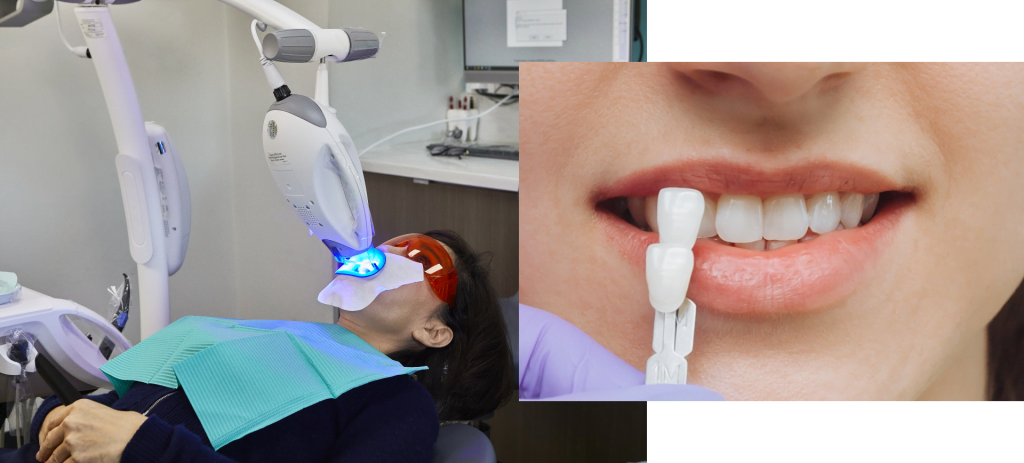 a patient having a professional in-chair teeth whitening service at Maidstone Dental Clinic