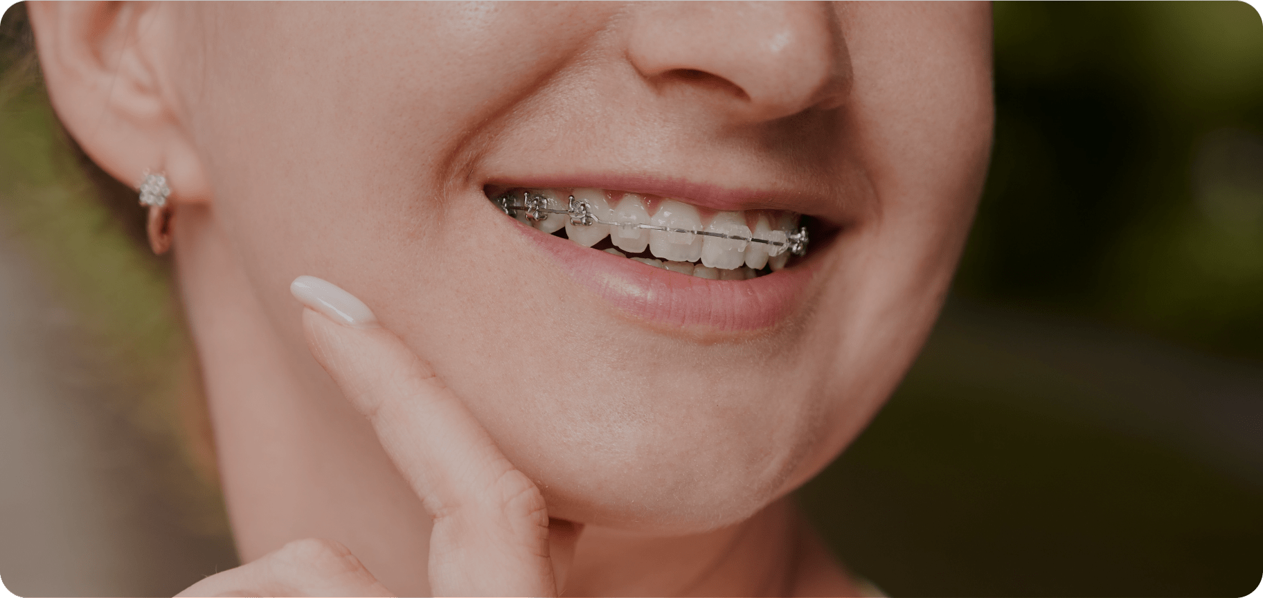 Orthodontic solutions for all ages at Maidstone Dental