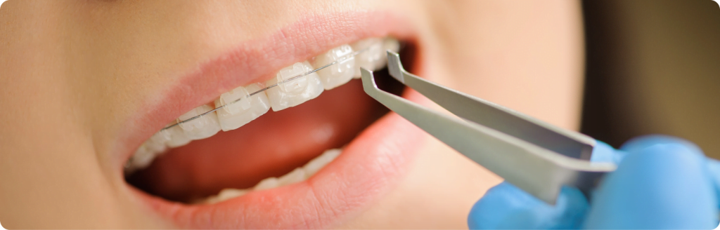 orthodontic treatment for all ages at Maidstone Dental