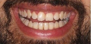Picture12